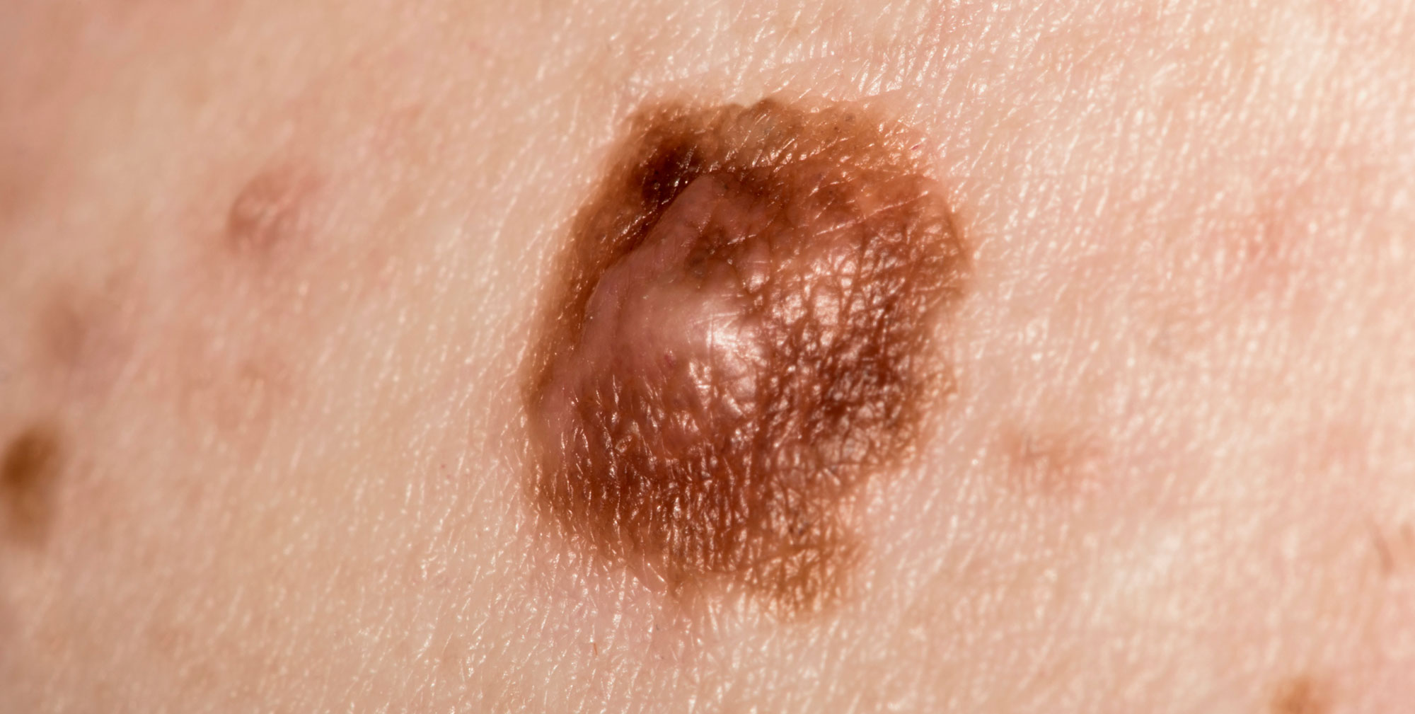 Q-Dermatology_Web-Banners_11