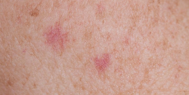 Q-Dermatology_Web-Banners_20