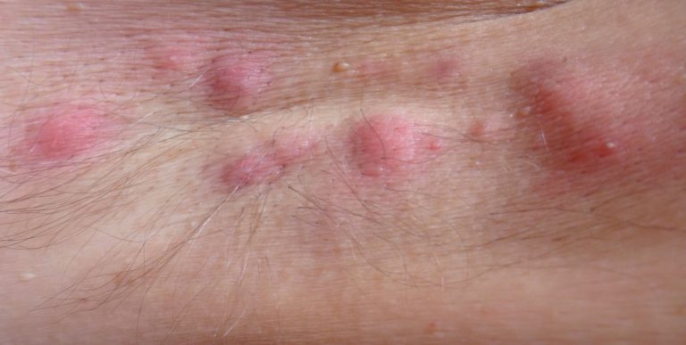 Q-Dermatology_Web-Banners_21