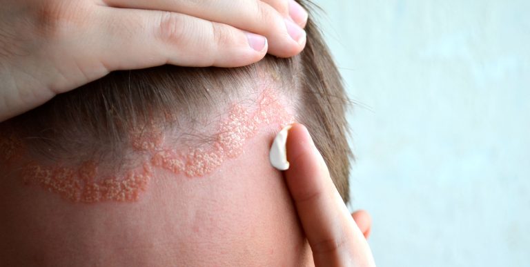 Q-Dermatology_Web-Banners_27