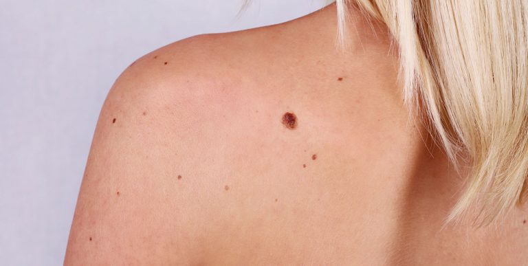 Q-Dermatology_Web-Banners_31