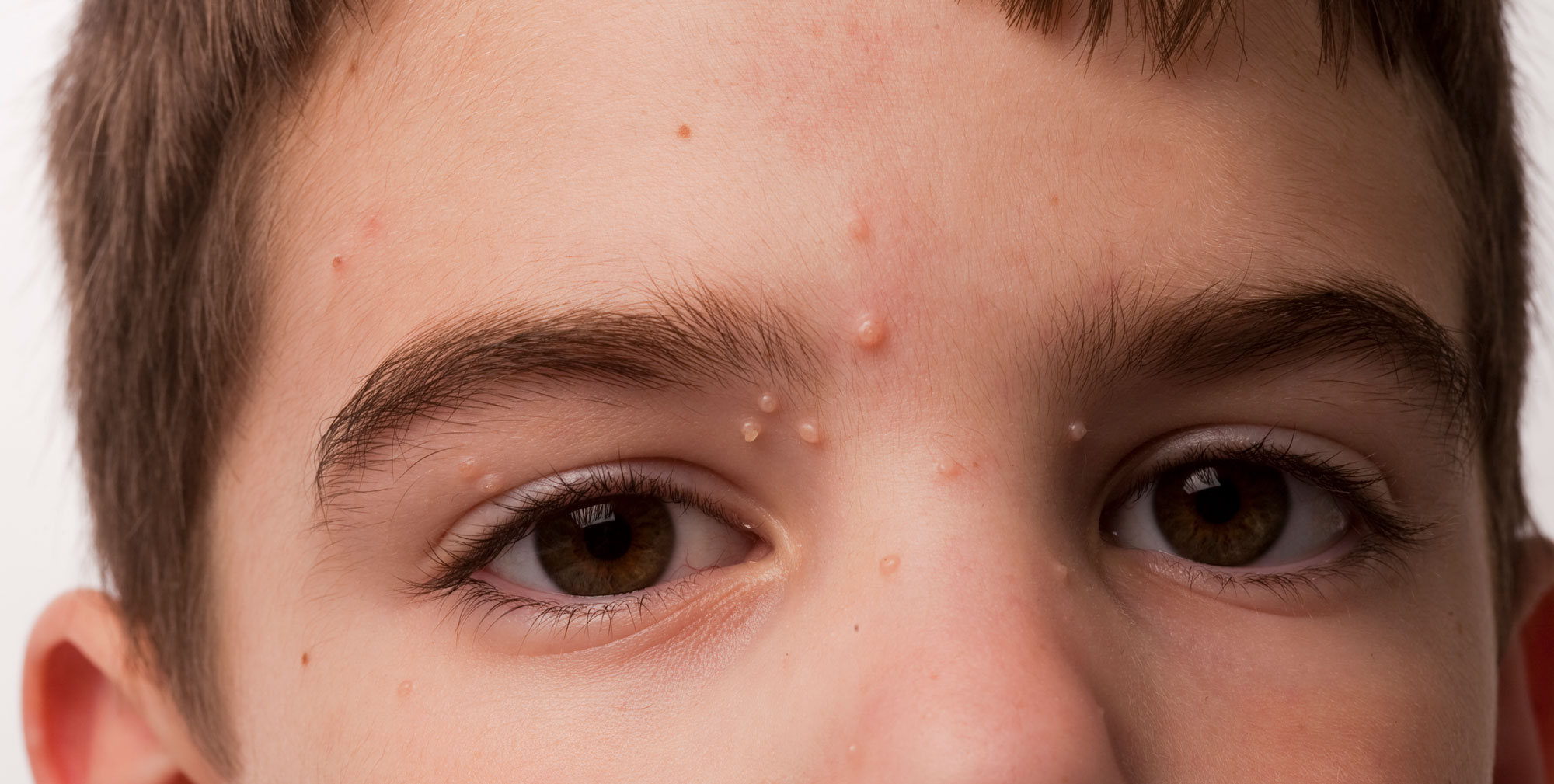 Q-Dermatology_Web-Banners_4